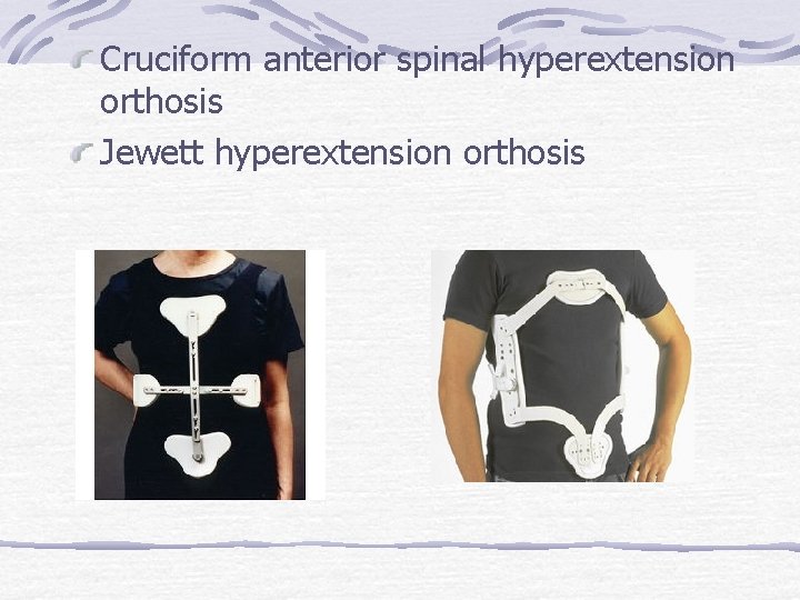 Cruciform anterior spinal hyperextension orthosis Jewett hyperextension orthosis 