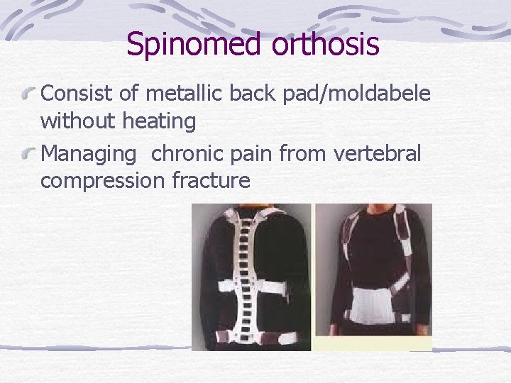 Spinomed orthosis Consist of metallic back pad/moldabele without heating Managing chronic pain from vertebral