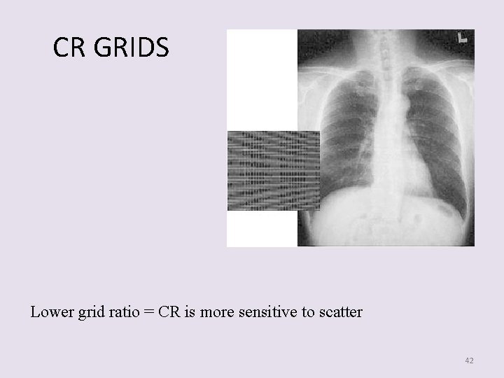 CR GRIDS Lower grid ratio = CR is more sensitive to scatter 42 