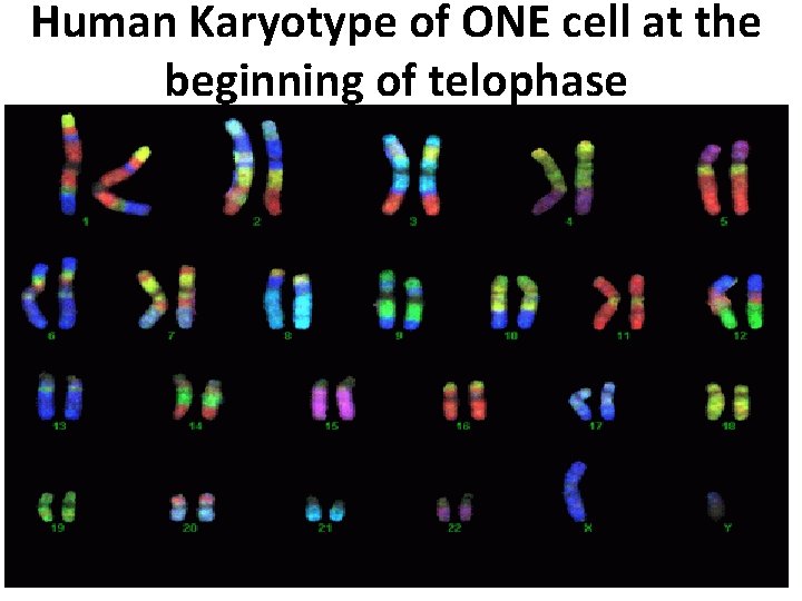 Human Karyotype of ONE cell at the beginning of telophase 