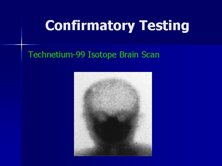 Confirmatory Testing Technetium-99 Isotope Brain Scan 