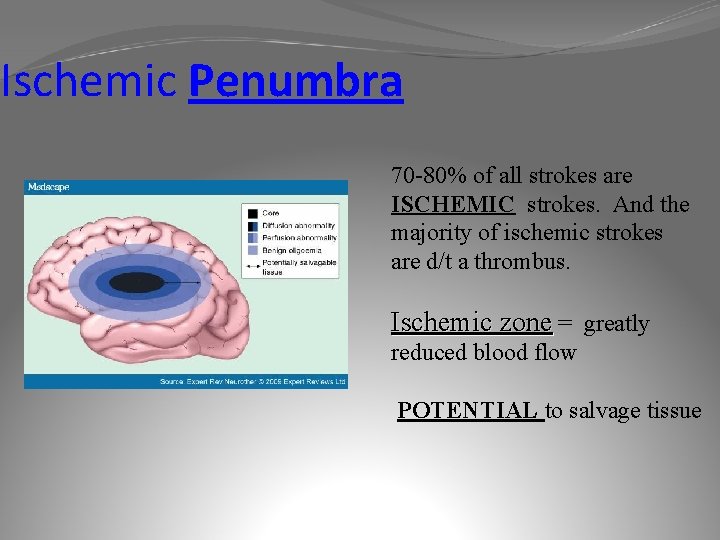 Ischemic Penumbra 70 -80% of all strokes are ISCHEMIC strokes. And the majority of
