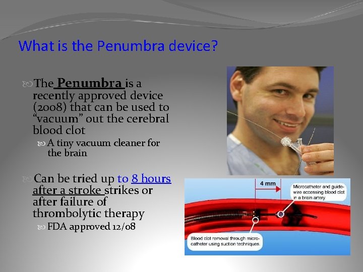 What is the Penumbra device? The Penumbra is a recently approved device (2008) that