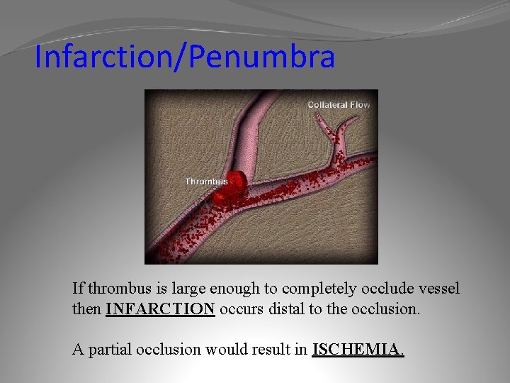 Infarction/Penumbra If thrombus is large enough to completely occlude vessel then INFARCTION occurs distal