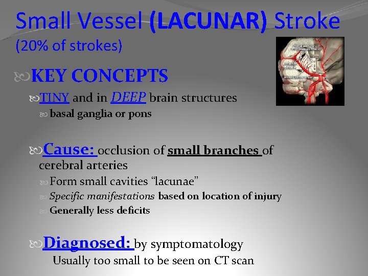 Small Vessel (LACUNAR) Stroke (20% of strokes) KEY CONCEPTS TINY and in DEEP brain