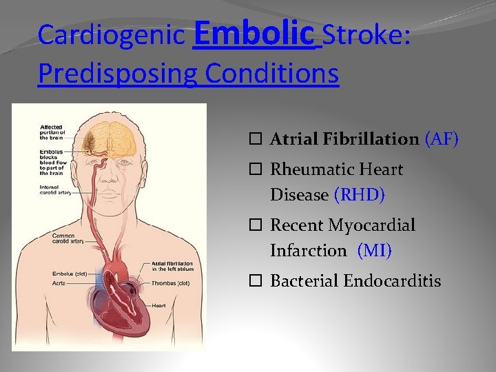 Cardiogenic Embolic Stroke: Predisposing Conditions Atrial Fibrillation (AF) Rheumatic Heart Disease (RHD) Recent Myocardial