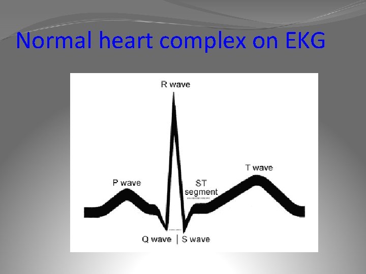 Normal heart complex on EKG 