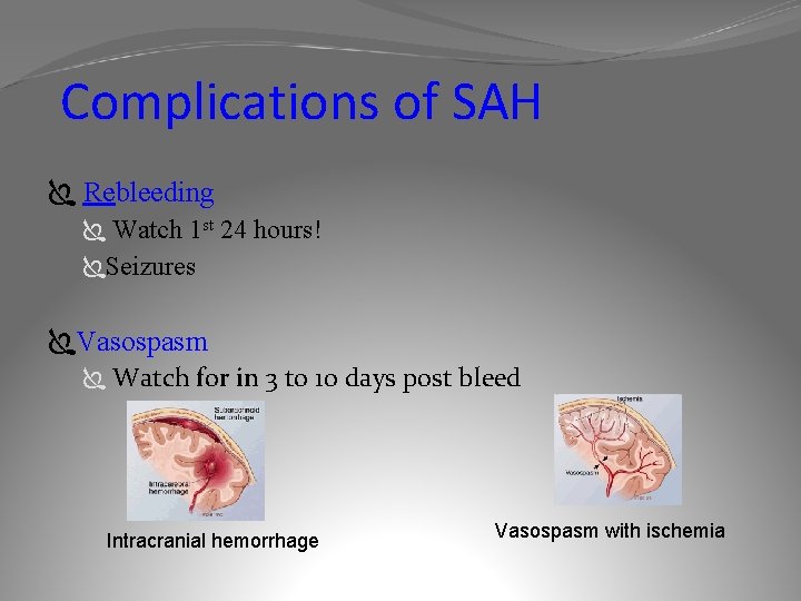 Complications of SAH Ï Rebleeding Ï Watch 1 st 24 hours! ÏSeizures ÏVasospasm Ï