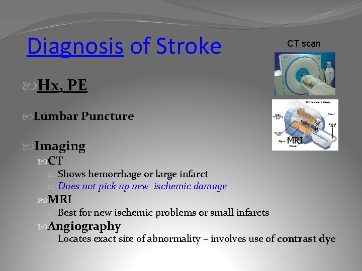 Diagnosis of Stroke CT scan Hx, PE Lumbar Puncture Imaging CT Shows hemorrhage or