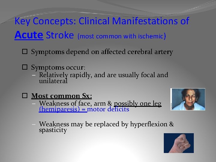 Key Concepts: Clinical Manifestations of Acute Stroke (most common with ischemic) Symptoms depend on