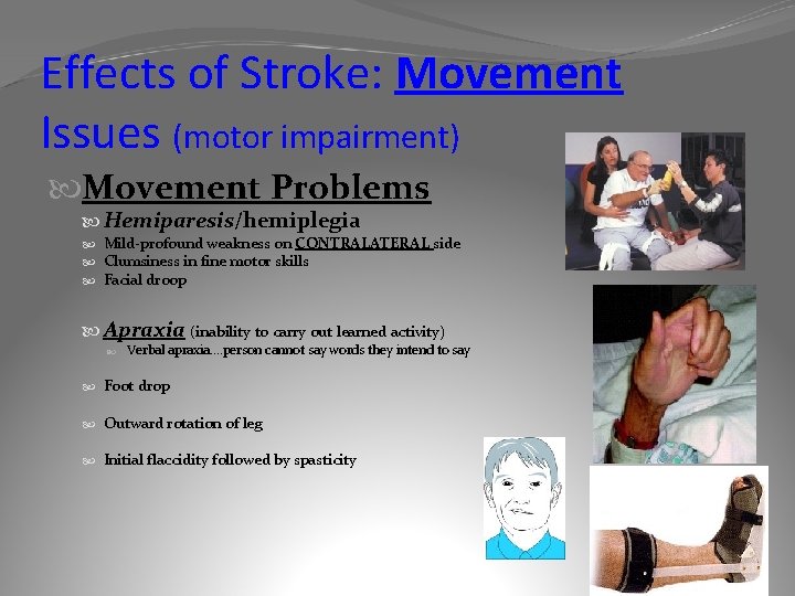 Effects of Stroke: Movement Issues (motor impairment) Movement Problems Hemiparesis/hemiplegia Mild-profound weakness on CONTRALATERAL