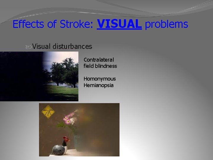 Effects of Stroke: VISUAL problems Visual disturbances Contralateral field blindness Homonymous Hemianopsia 