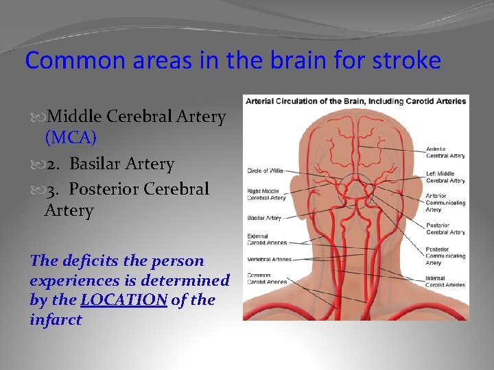 Common areas in the brain for stroke Middle Cerebral Artery (MCA) 2. Basilar Artery