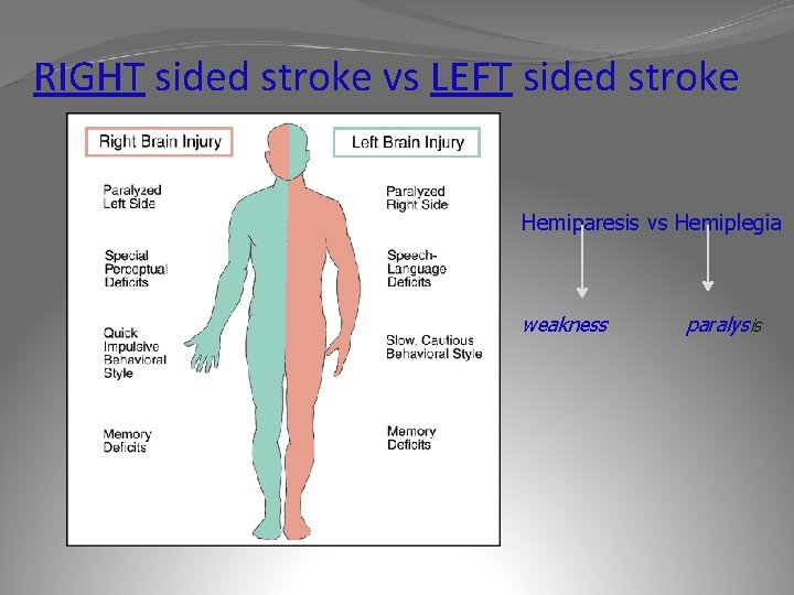 RIGHT sided stroke vs LEFT sided stroke Hemiparesis vs Hemiplegia weakness paralysis 