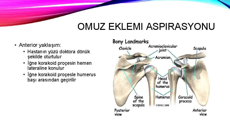 OMUZ EKLEMI ASPIRASYONU • Anterior yaklaşım: • Hastanın yüzü doktora dönük şekilde oturtulur •