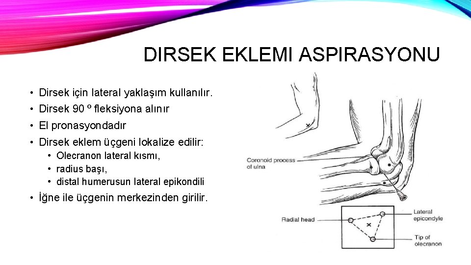 DIRSEK EKLEMI ASPIRASYONU • Dirsek için lateral yaklaşım kullanılır. • Dirsek 90 º fleksiyona