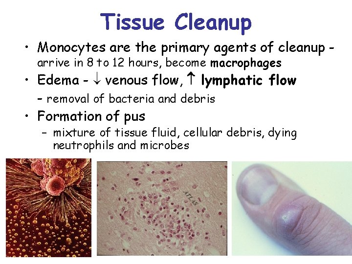 Tissue Cleanup • Monocytes are the primary agents of cleanup arrive in 8 to