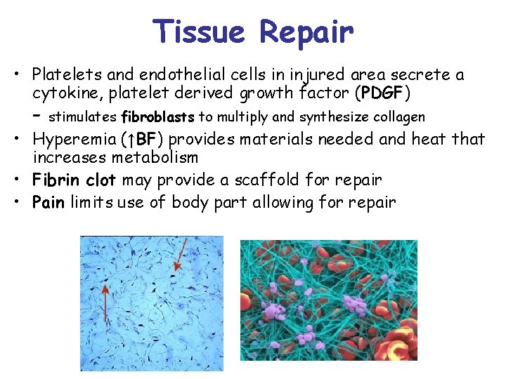 Tissue Repair • Platelets and endothelial cells in injured area secrete a cytokine, platelet