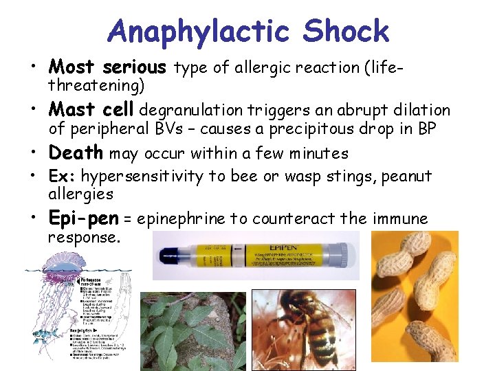 Anaphylactic Shock • Most serious type of allergic reaction (lifethreatening) • Mast cell degranulation