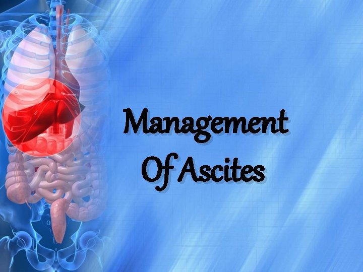 Management Of Ascites 