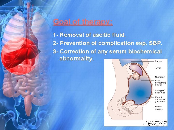 Goal of therapy: 1 - Removal of ascitic fluid. 2 - Prevention of complication