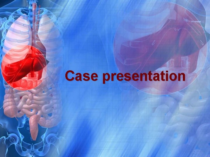 Case presentation 