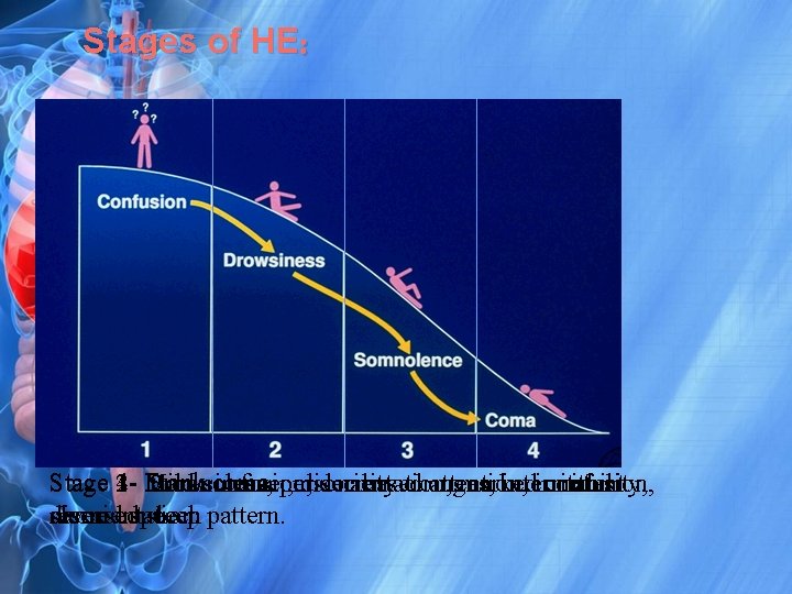 Stages of HE: Stage 4 coma personality 1 - Frank 23 Mild Drowsiness, Somnolence