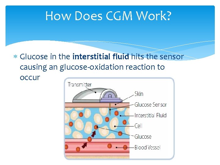 How Does CGM Work? Glucose in the interstitial fluid hits the sensor causing an
