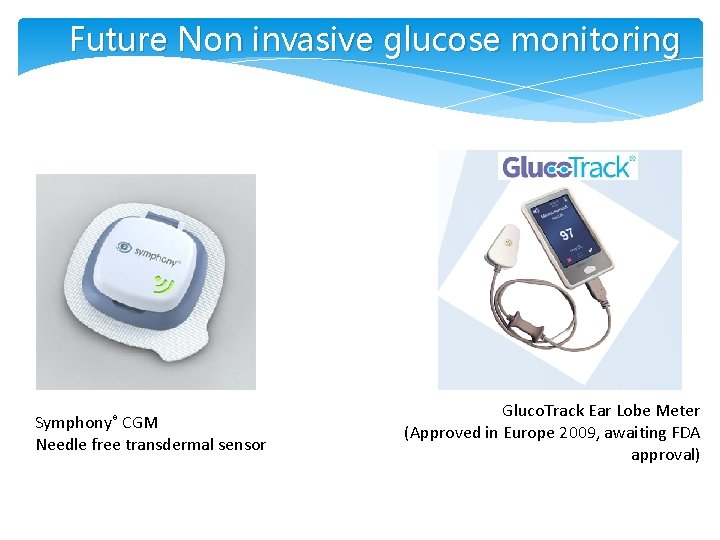 Future Non invasive glucose monitoring Symphony® CGM Needle free transdermal sensor Gluco. Track Ear