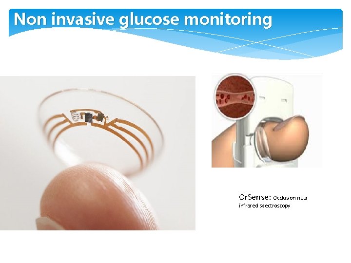 Non invasive glucose monitoring Or. Sense: Occlusion near infrared spectroscopy 