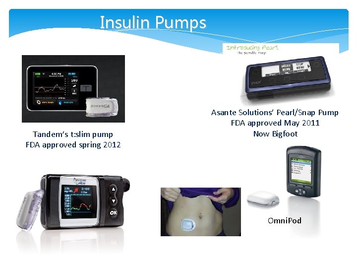 Insulin Pumps Tandem’s t: slim pump FDA approved spring 2012 Asante Solutions’ Pearl/Snap Pump