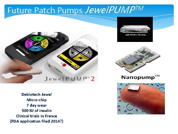 Future Patch Pumps Jewel. PUMPTM Debiotech Jewel Micro-chip 7 day wear 500 IU of