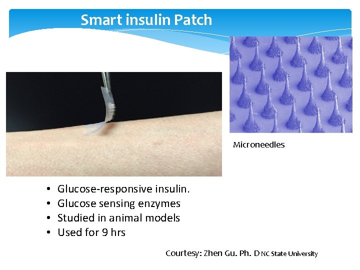 Smart insulin Patch Microneedles • • Glucose-responsive insulin. Glucose sensing enzymes Studied in animal