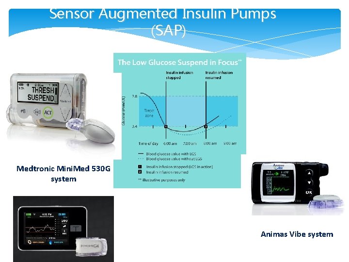 Sensor Augmented Insulin Pumps (SAP) Medtronic Mini. Med 530 G system Animas Vibe system