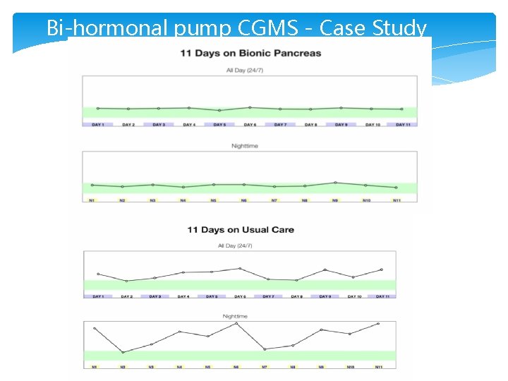 Bi-hormonal pump CGMS - Case Study 