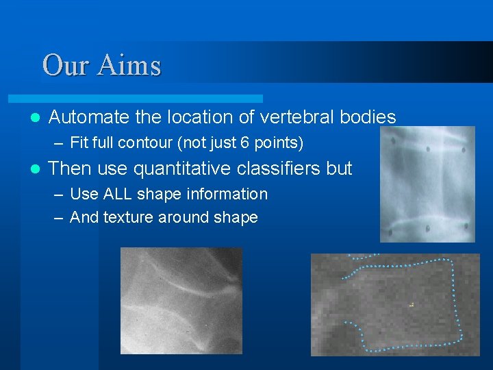 Our Aims l Automate the location of vertebral bodies – Fit full contour (not
