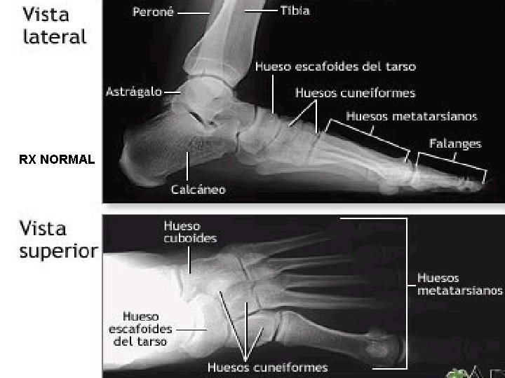 RX NORMAL 