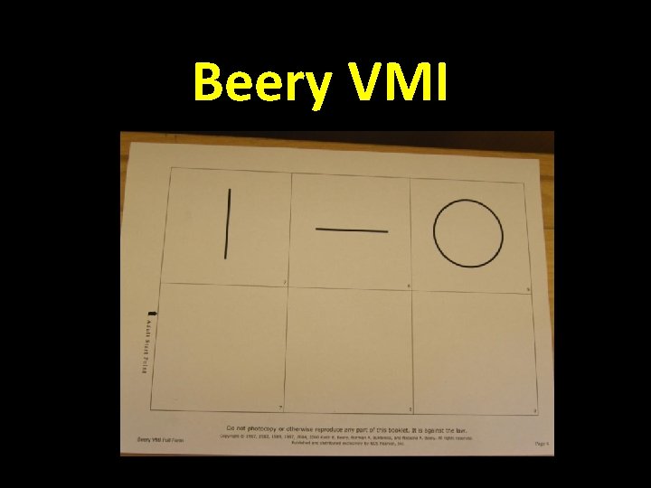 Beery VMI 