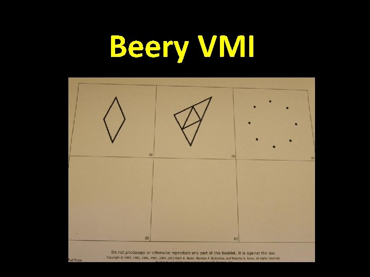 Beery VMI 