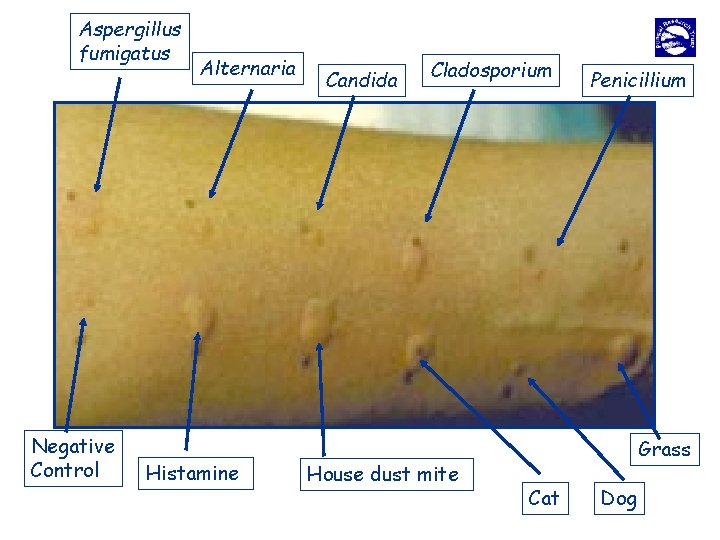 Aspergillus fumigatus Negative Control Alternaria Histamine Candida Cladosporium House dust mite Penicillium Grass Cat