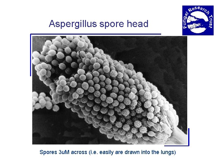 Aspergillus spore head Spores 3 u. M across (i. e. easily are drawn into