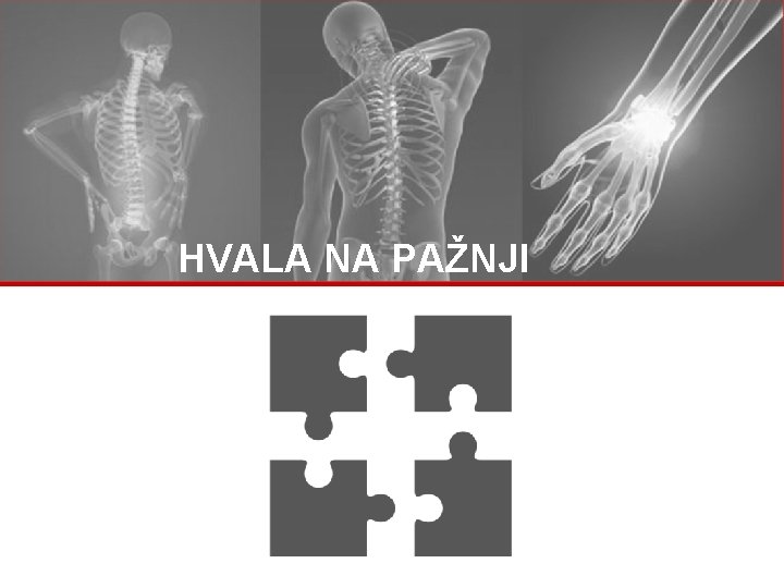 HVALA NA PAŽNJI 