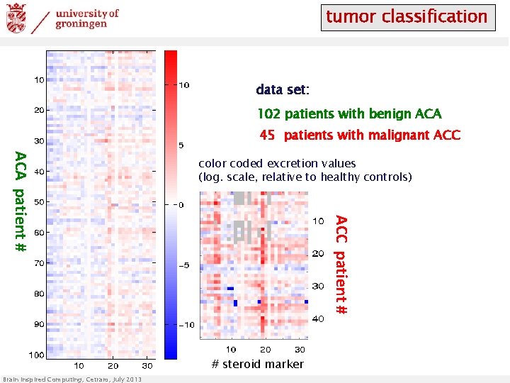 tumor classification data set: 102 patients with benign ACA 45 patients with malignant ACC