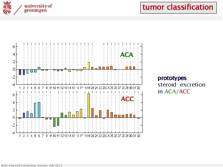 tumor classification ACA ACC Brain Inspired Computing, Cetraro, July 2013 prototypes: steroid excretion in