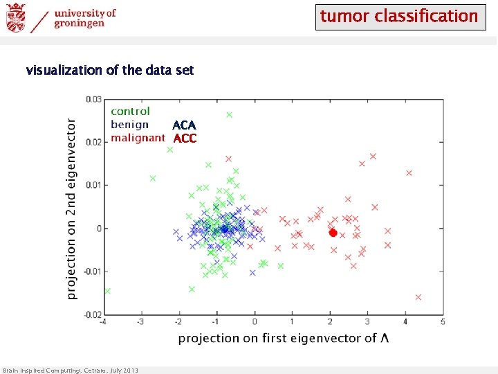 tumor classification visualization of the data set ACA ACC Brain Inspired Computing, Cetraro, July