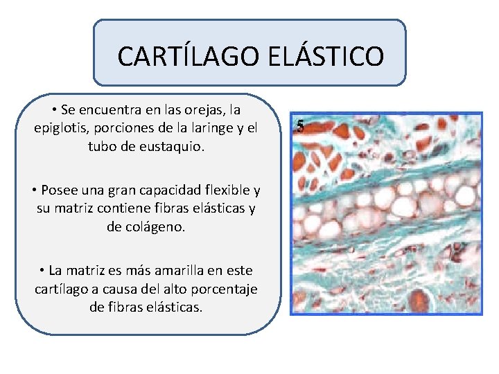 CARTÍLAGO ELÁSTICO • Se encuentra en las orejas, la epiglotis, porciones de la laringe