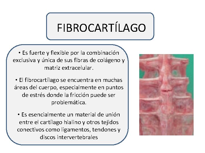 FIBROCARTÍLAGO • Es fuerte y flexible por la combinación exclusiva y única de sus