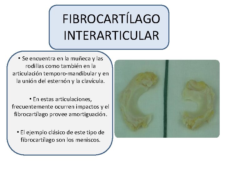 FIBROCARTÍLAGO INTERARTICULAR • Se encuentra en la muñeca y las rodillas como también en