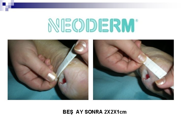 BEŞ AY SONRA 2 X 2 X 1 cm 