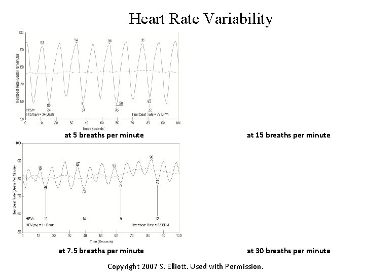 Heart Rate Variability at 5 breaths per minute at 15 breaths per minute at